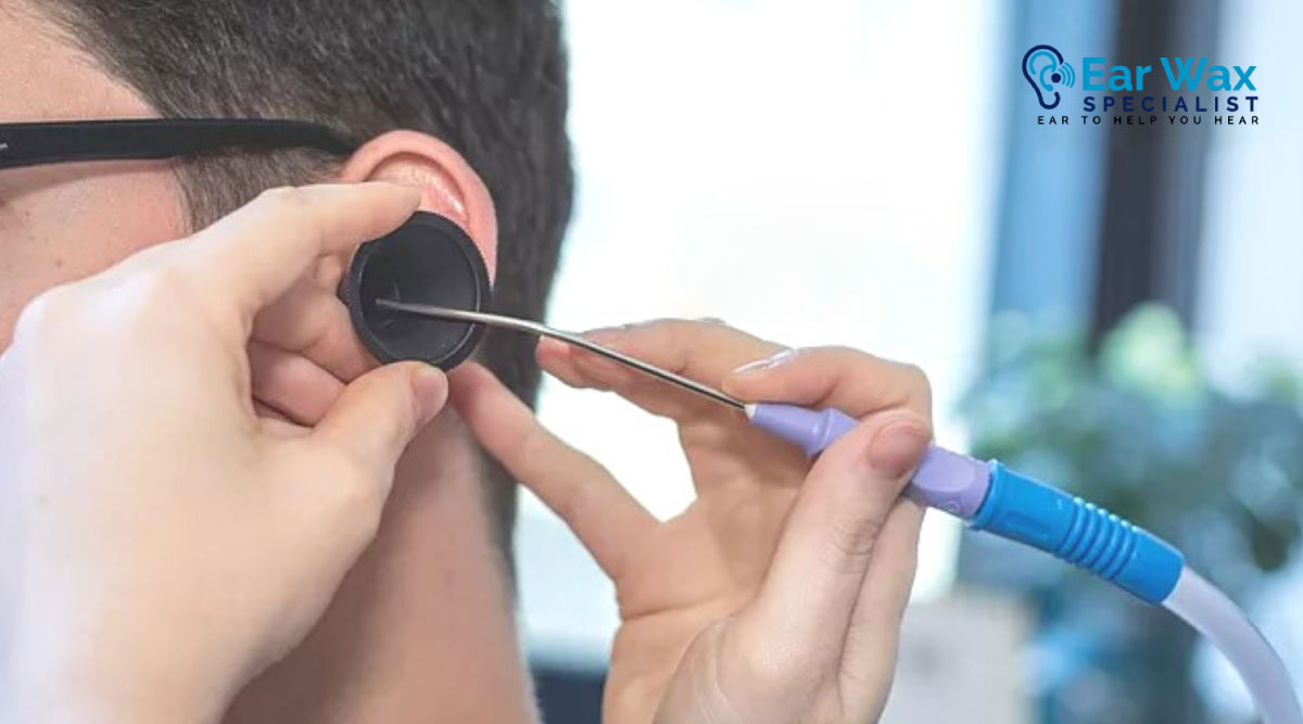 Safe Removal Options: Home Softening → Professional Care